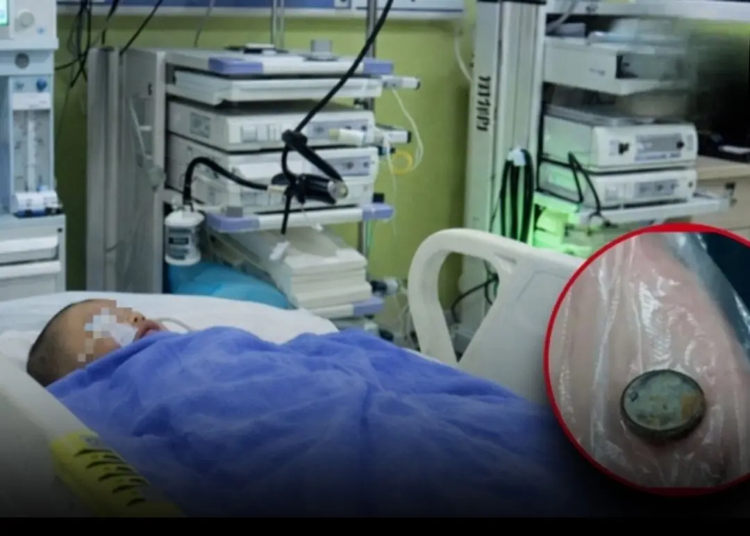 3-Year-Old Swallows Battery—Mom’s Quick Action Saves Him