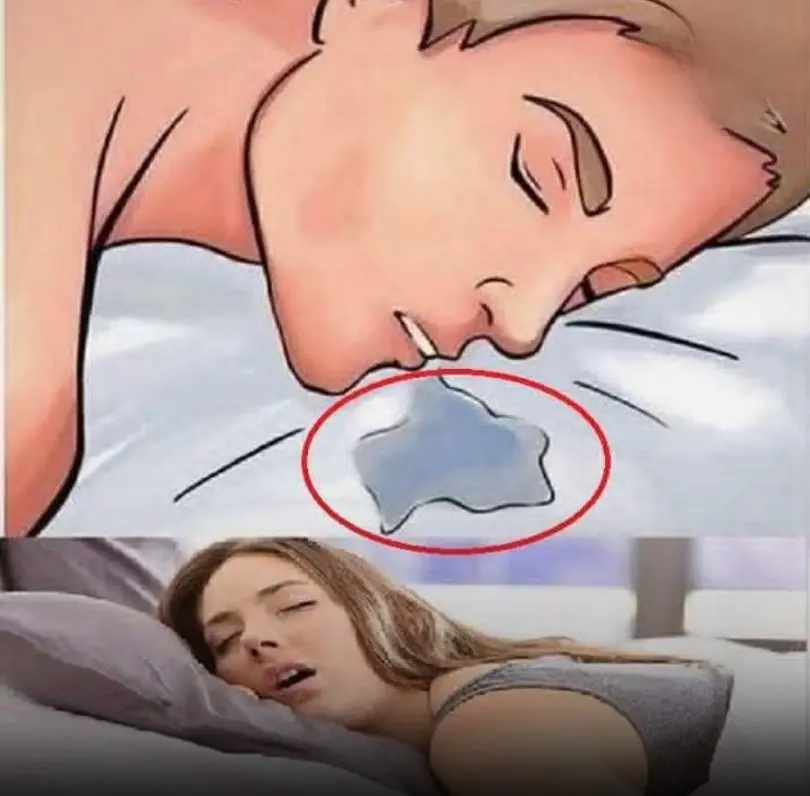 Don’t Ignore Frequent Drooling