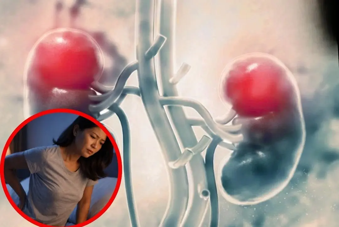 Don’t Ignore These 5 Nighttime Symptoms of Kidney Trouble