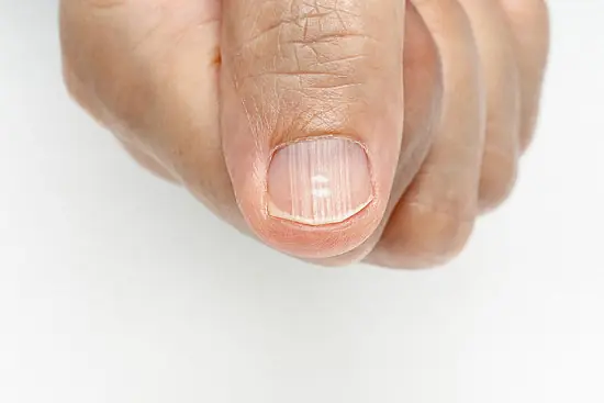 4 Changes in Your Hands and Feet That May Signal Early Can.cer, Experts Warn