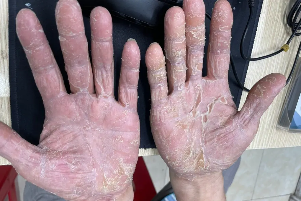 If you notice this on your hands, it’s not always just dry skin
