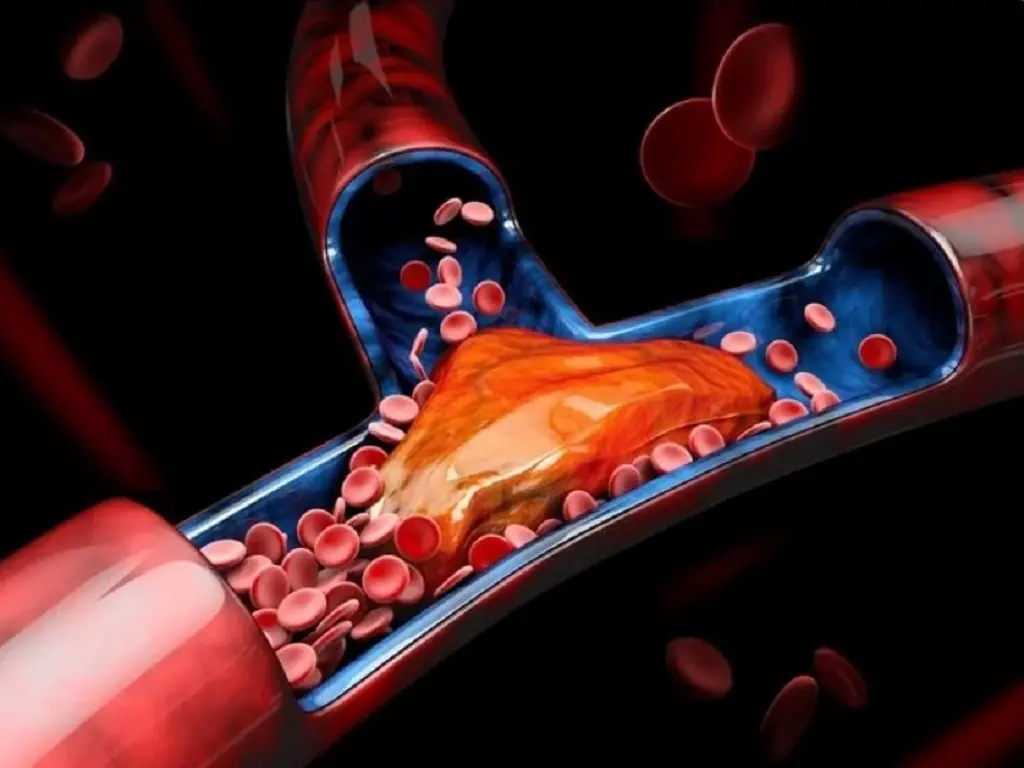 Foods That May Boost Blood Circulation and Lower the Risk of Blood Clots