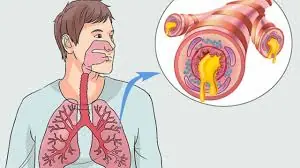 This easy 2-ingredient remedy may help reduce mucus in your throat and lungs
