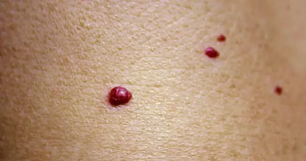 Tiny Red Spots on Your Skin: Causes, What They Mean, and When to Be Concerned