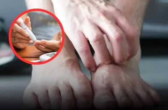 When you see these 4 conditions while walking, be alert for diabetes