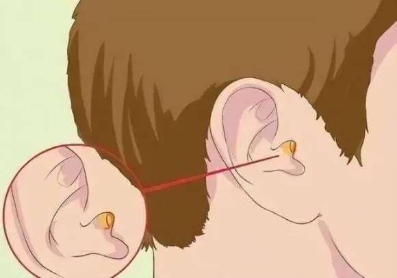 If ear itching happens often, doctors advise checking for these 4 conditions