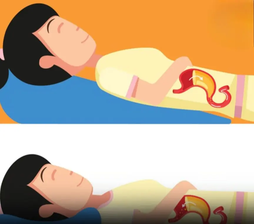 Struggling with acid reflux? Try these 3 natural solutions