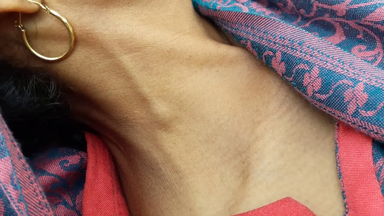 Noticeably swo.llen jugular veins can be a warning sign of deeper health concerns