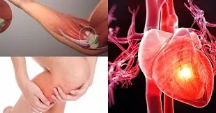 7 Warning Signs of a Heart Attack That Can Appear Weeks in Advance