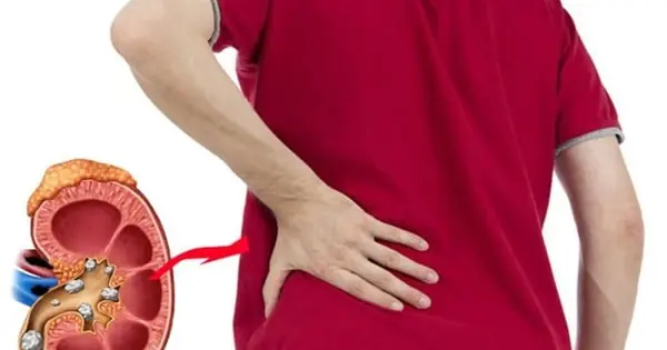 When these symptoms appear, your kidneys may be signaling a problem
