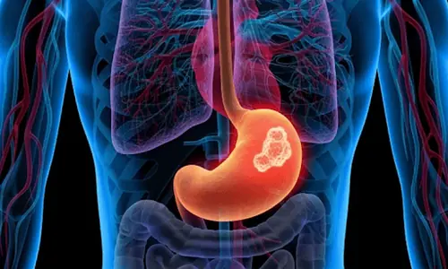 10 Hidden Symptoms of Advanced Stomach Can.cer You Should Know About