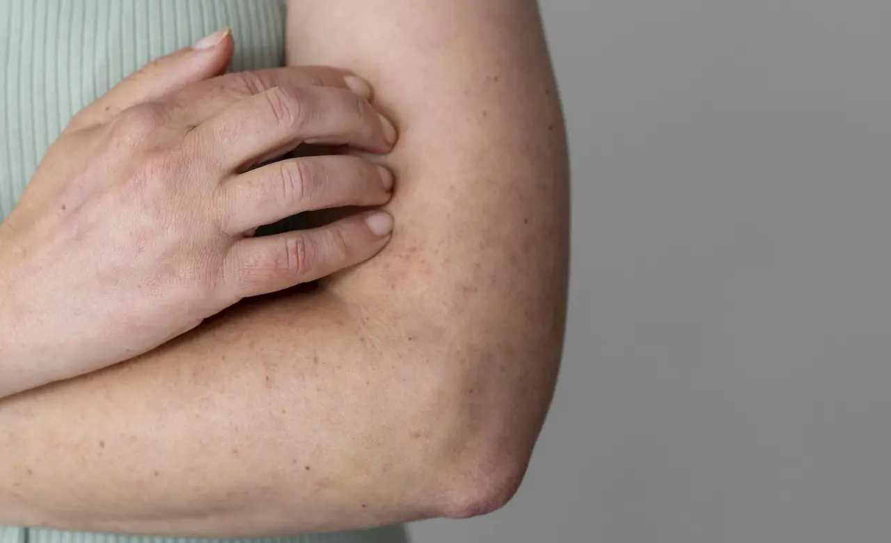 If you experience unusual itching in these areas, your liver may need attention