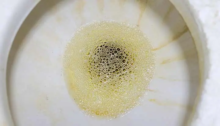 Foamy Urine: What Those Bubbles Really Mean — And When You Should See a Doctor