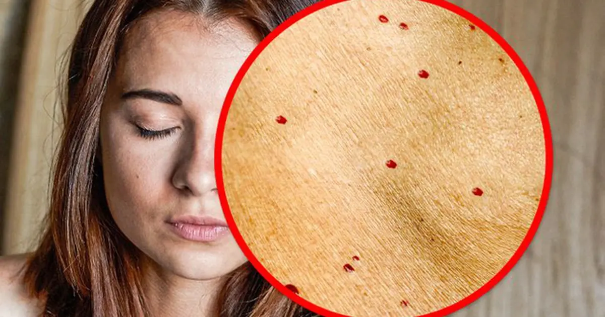 These Small Red Dots on Your Skin May Reveal Important Clues About Your Health