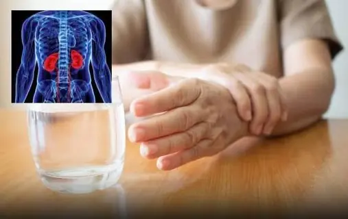People with liver failure often have 3 characteristics on their hands, if you have 1 you should see a doctor soon