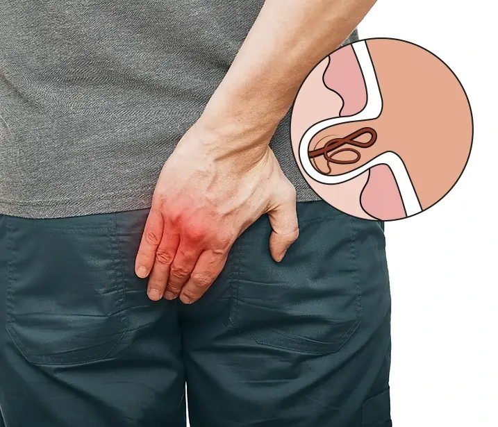 H. pylori Cases Are Rising — Watch Out for These Dangerous Warning Signs