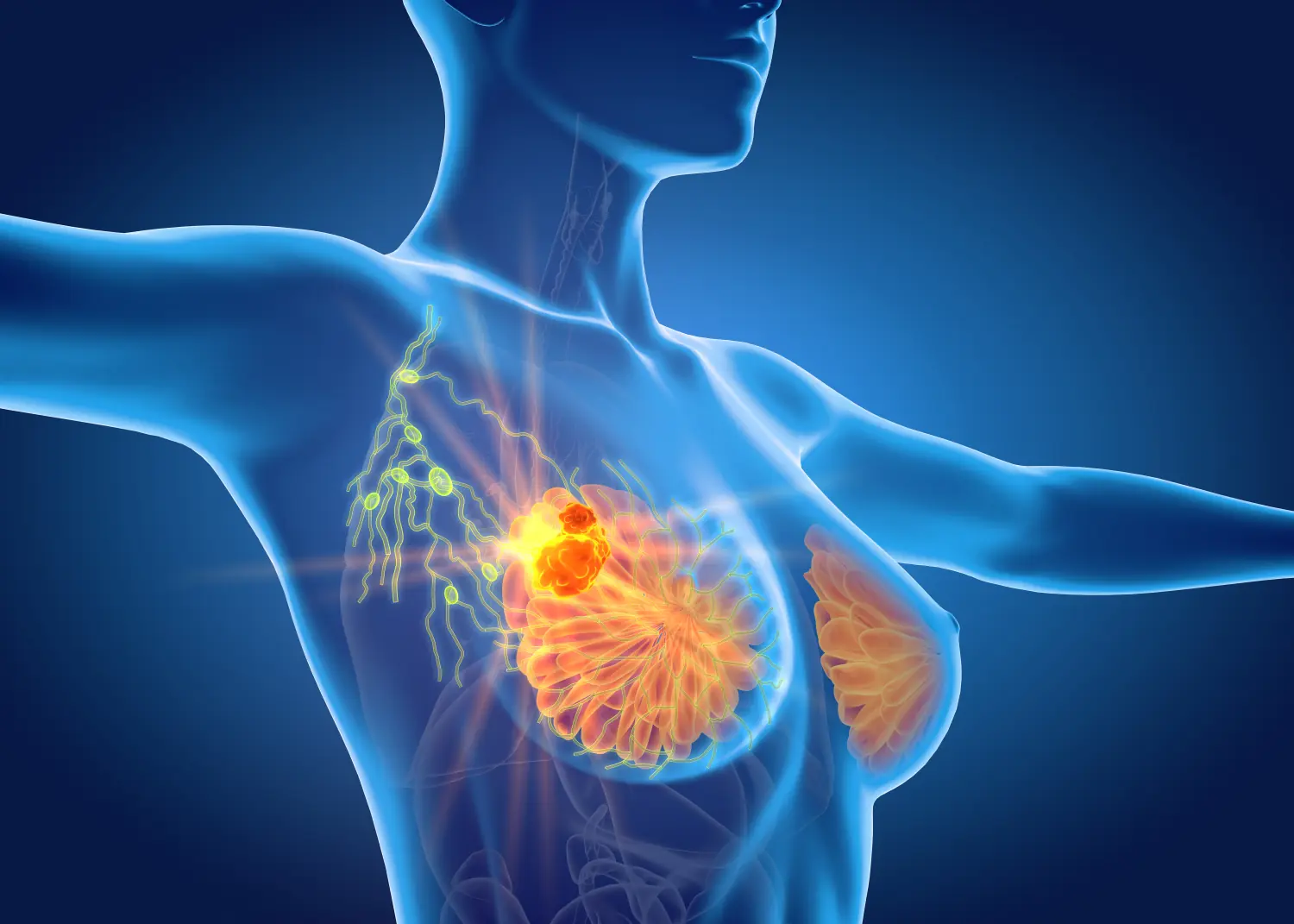 10 Warning Signs of Bre.ast Can.cer You Should Never Ignore