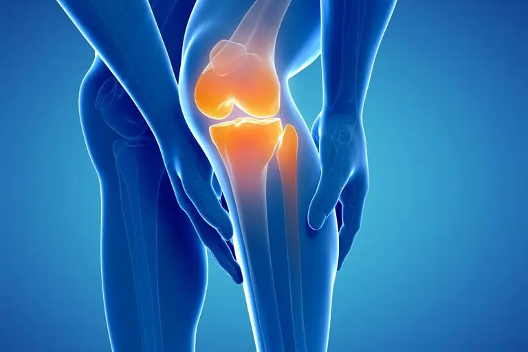 7 Early Signs of Arthritis You Should Pay Attention To