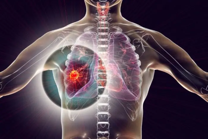 12 Important Can.cer Warning Signs Many People Don’t Recognize