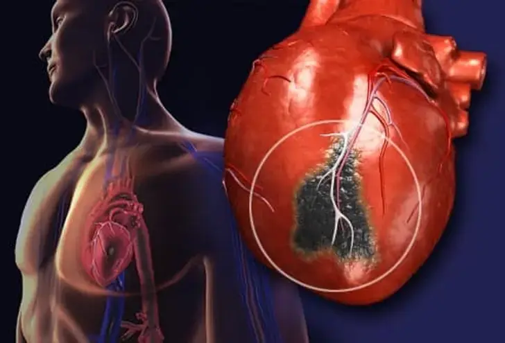 These 7 Warning Signs May Appear Before a Heart Attack — Especially the 6th