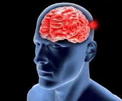 Doctors Warn: Don’t Ignore These Possible Aneurysm Symptoms