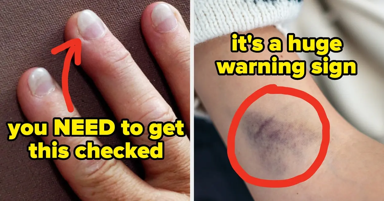 25 Red Flags Your Body May Be Sending About Serious Health Conditions