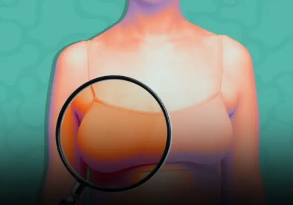 The First Signals Are Subtle: Breast Cancer Symptoms That May Appear a Year Earlier