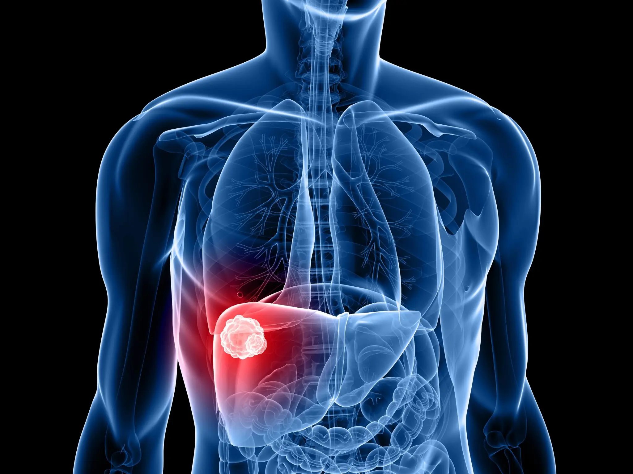 A 20-year-old teacher ignored subtle symptoms before li.ver can.cer changed everything