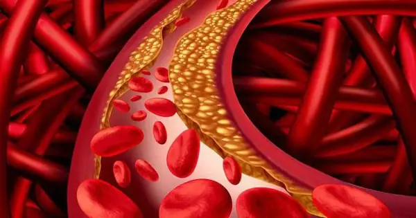 Signs in the Feet That May Be Connected to Clogged Arteries and Heart Health