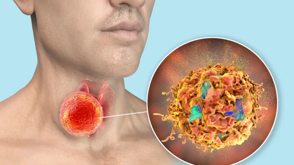 Why You Keep Feeling Mucus in Your Throat — And What Could Be Causing It