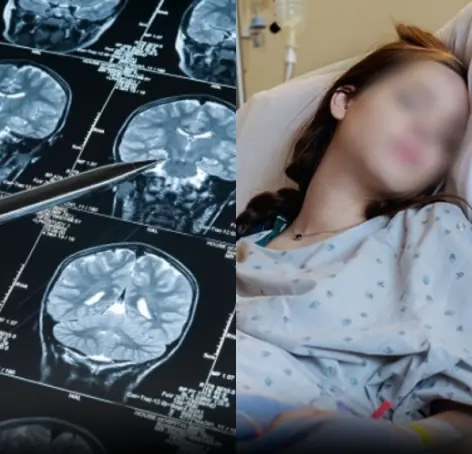 5 Alarming Stroke Warning Signs to Watch for in Young People