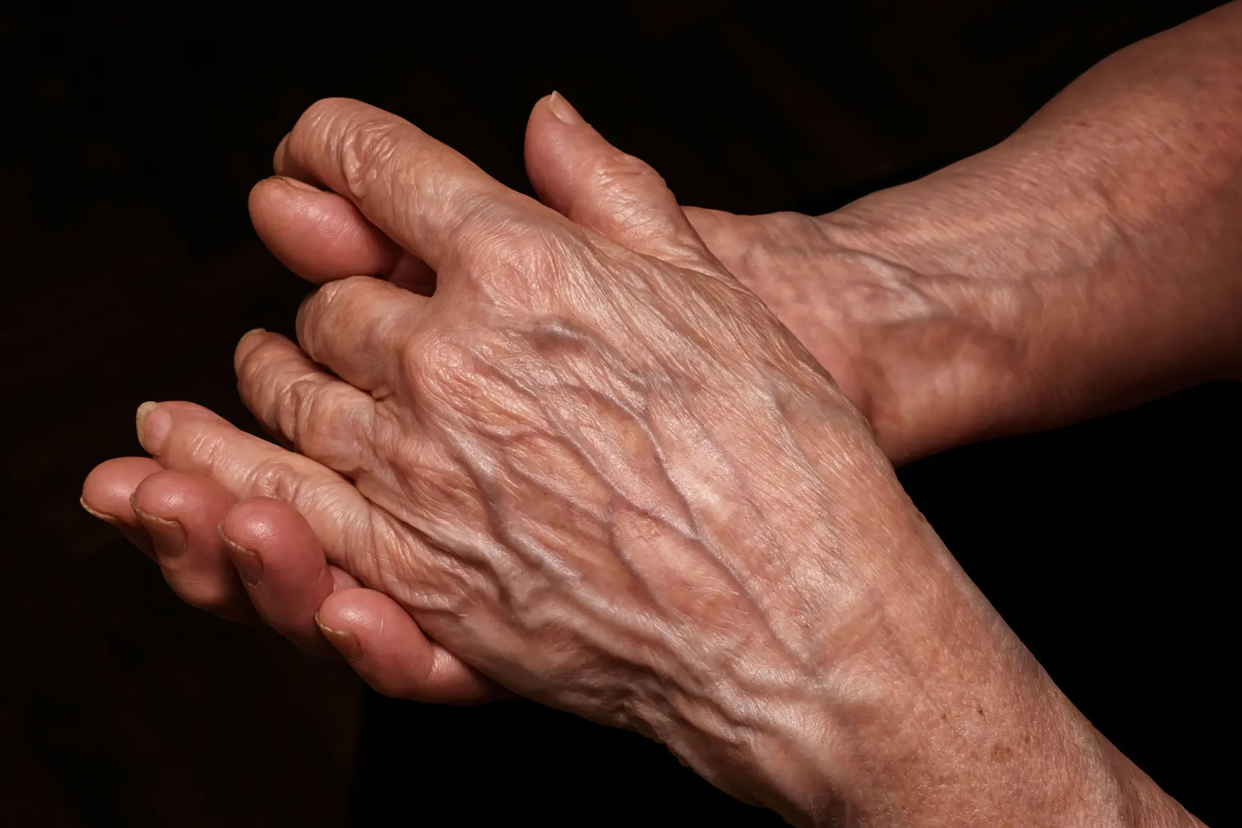 If Your Hand Veins Are Bulging or More Noticeable, Don’t Ignore These Possible Causes