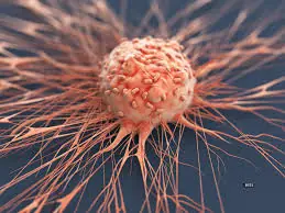 10 Sneaky Cancer Symptoms That Are Often Mistaken for Minor Problems