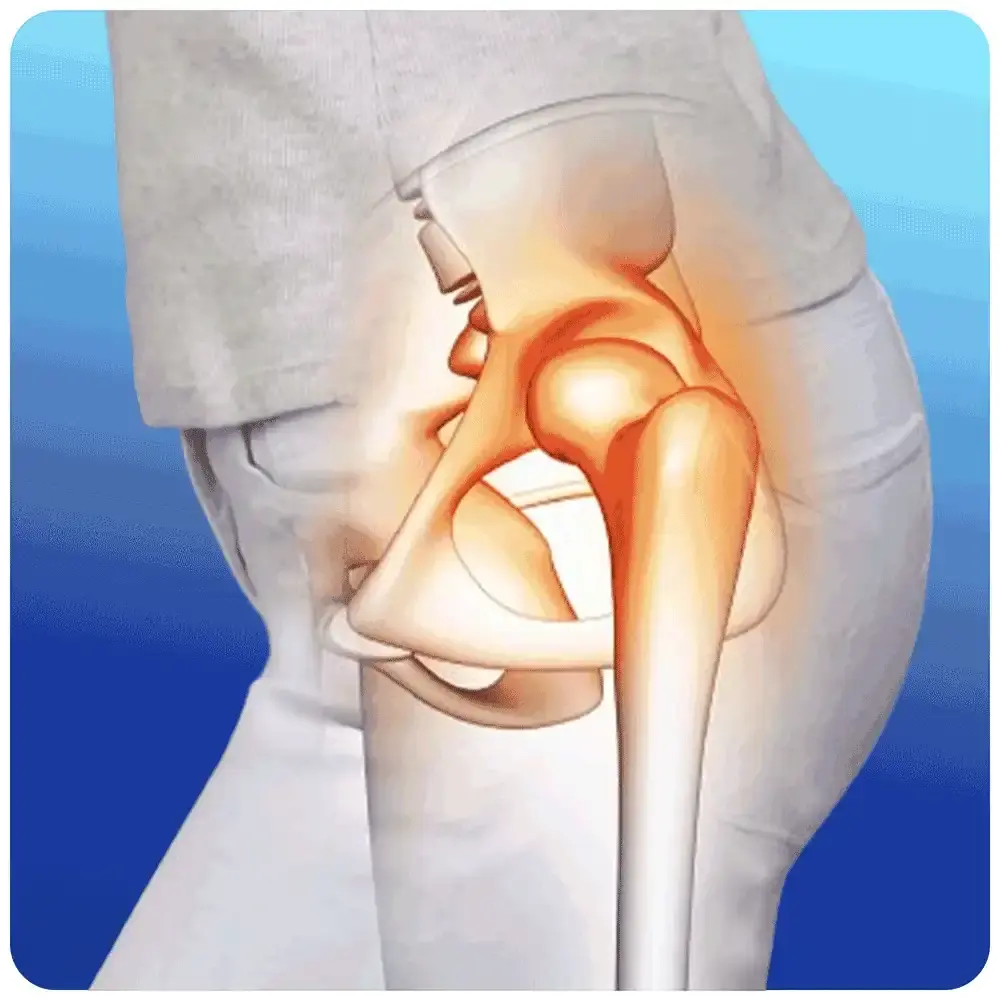 If Your Hips Hurt Often, These Hidden Causes Might Surprise You