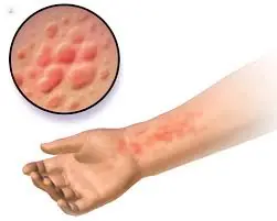 Your Body May Show These 10 Signs of Kidney Disease Before It Gets Serious