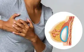Bre.ast Can.cer May Begin With Quiet Symptoms — Learn to Recognize Them