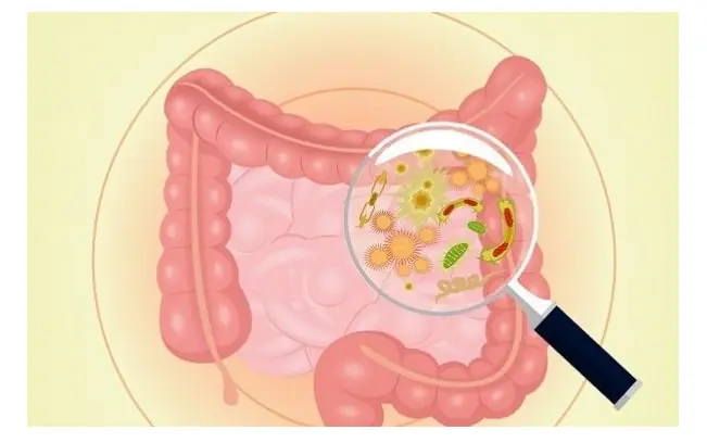 6 Warning Signs That Digestive Problems May Be More Serious Than You Think