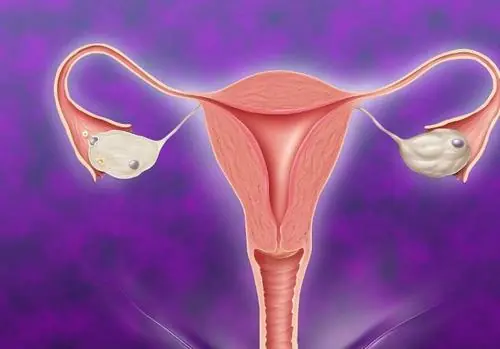 8 Possible Early Warning Signs of Cervical Can.cer Women Should Not Ignore