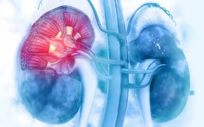 Why Kidney Damage Is Becoming More Common at Younger Ages?