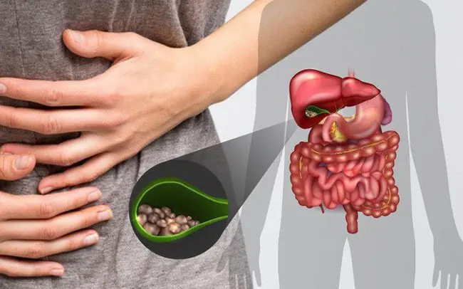 6 Quiet Warning Signs That Could Indicate Gallbladder Can.cer