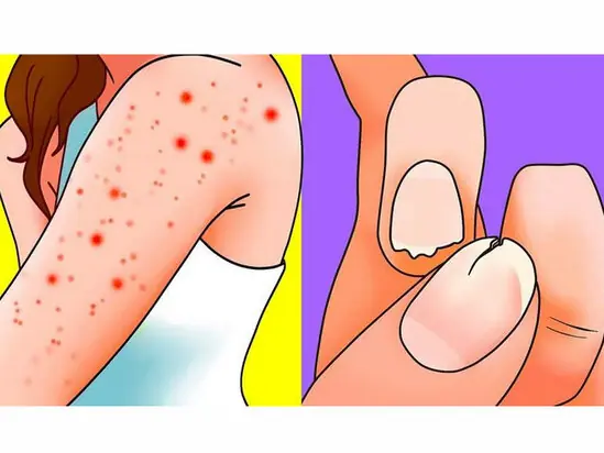 12 Common Symptoms That May Sometimes Be Associated With Cancer
