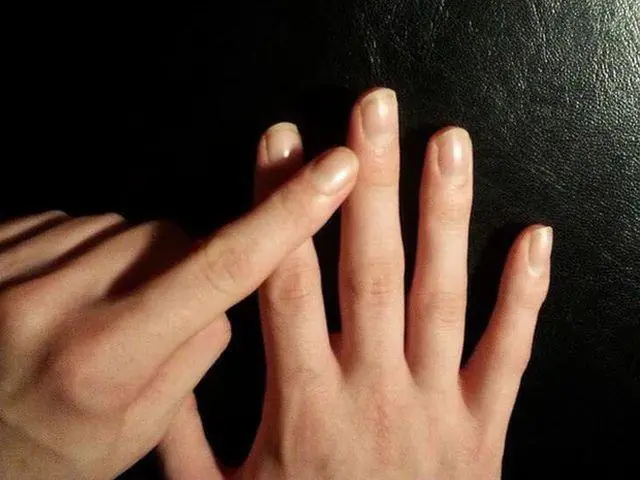What to Know About the Finger Sign Sometimes Associated With Lung Conditions?