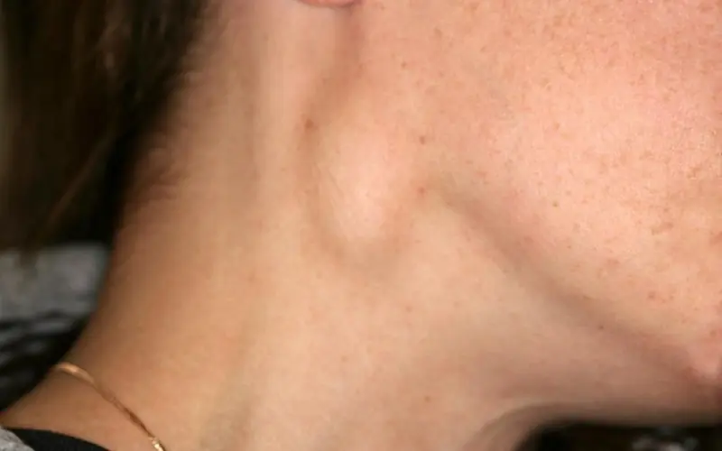 3 Neck Warning Signs That May Point to Can.cer