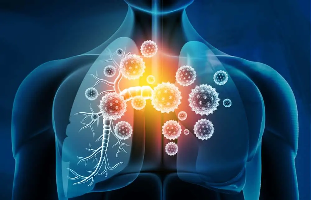 Pain in Certain Areas of the Body May Sometimes Be Linked to Lung Problems