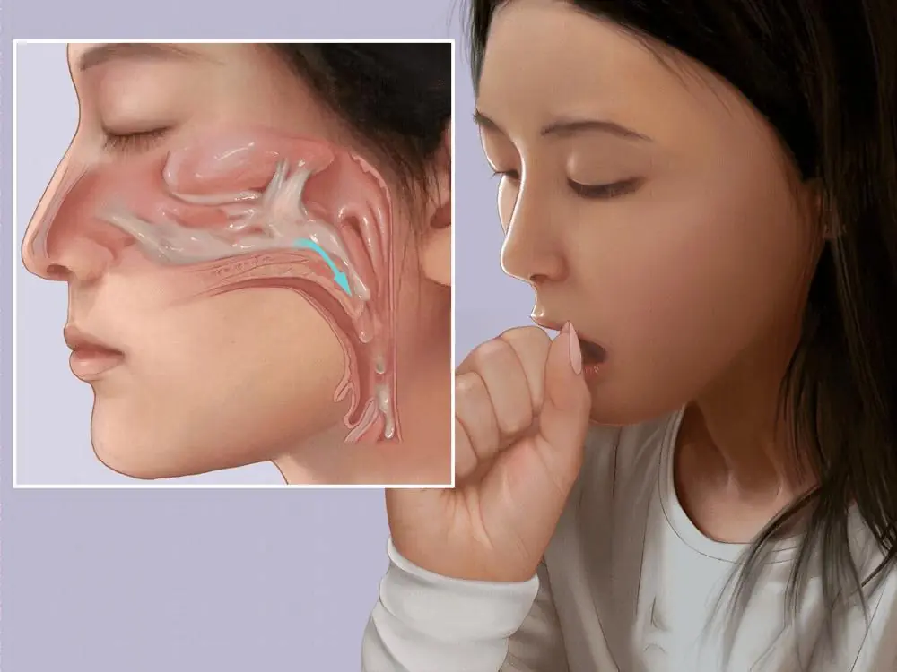 What Causes Constant Thick Mucus Buildup in the Throat?