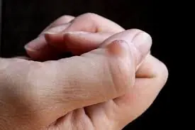 This type of lump doesn’t always appear by chance — it can be caused by something you repeat every day…
