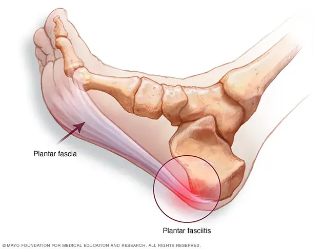 Leg Numbness That Happens Often May Signal an Underlying Health Issue