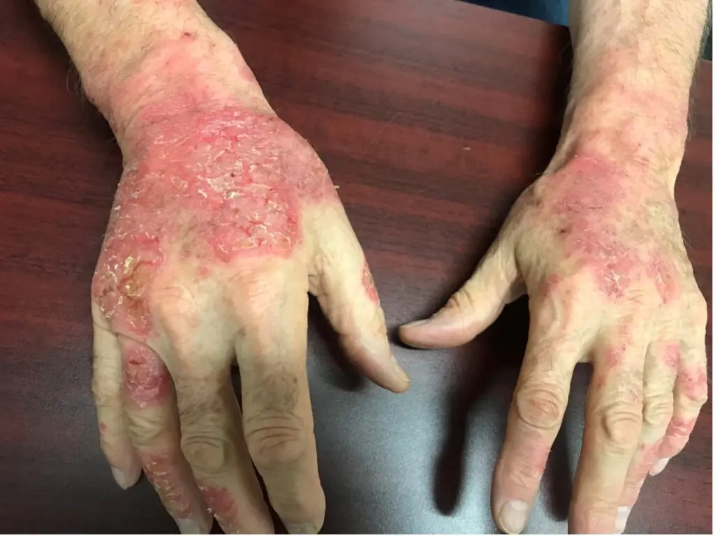 Skin Irritation During Sleep? Experts Say Your Body May Be Reacting to Something