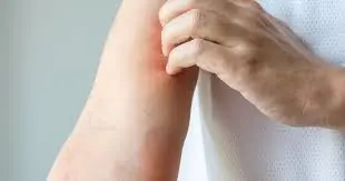 What Looked Harmless on Her Skin Turned Out to Be Devastating