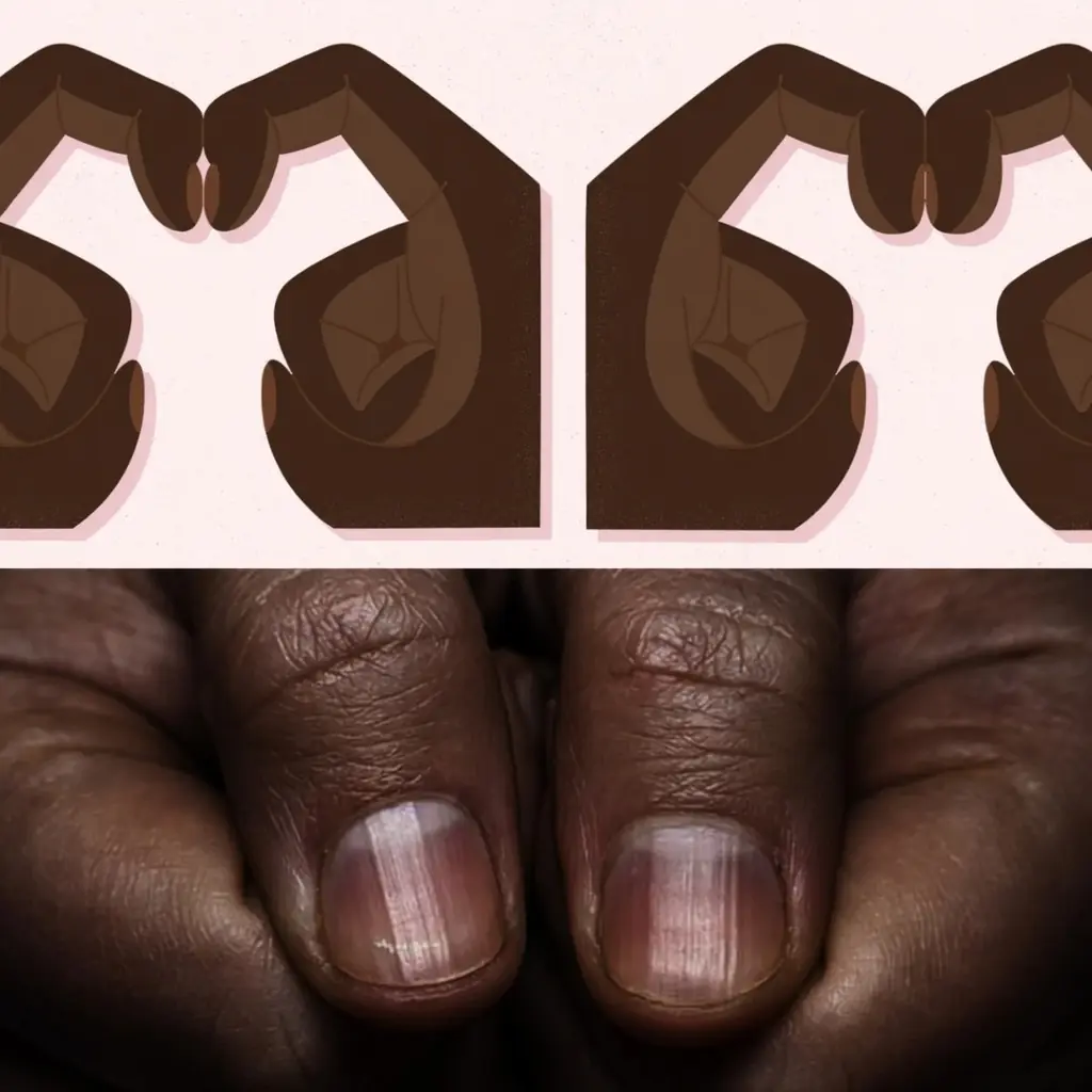 7 Finger Changes That Could Signal Lung Health Problems You Shouldn’t Ignore